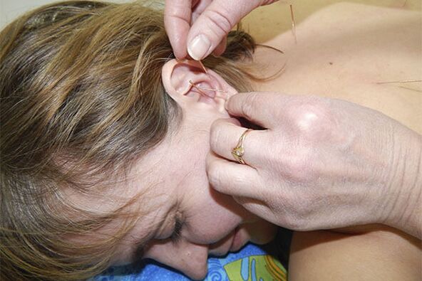 akupunktura w osteochondrozie lędźwiowej