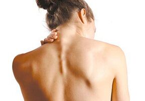 Jak objawia się osteochondroza szyjki macicy