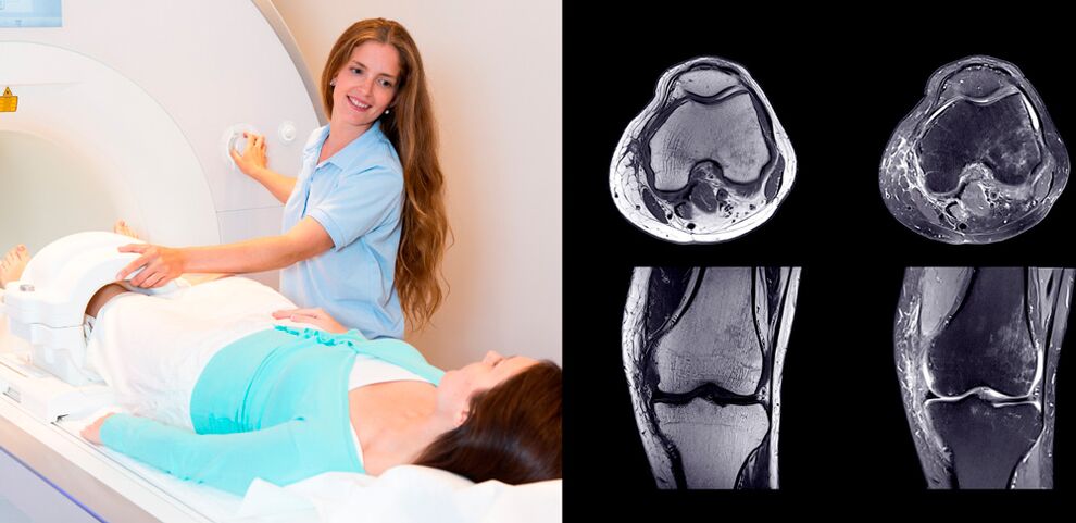 diagnostyka stawu kolanowego