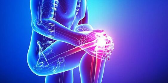 silny ból stawu kolanowego