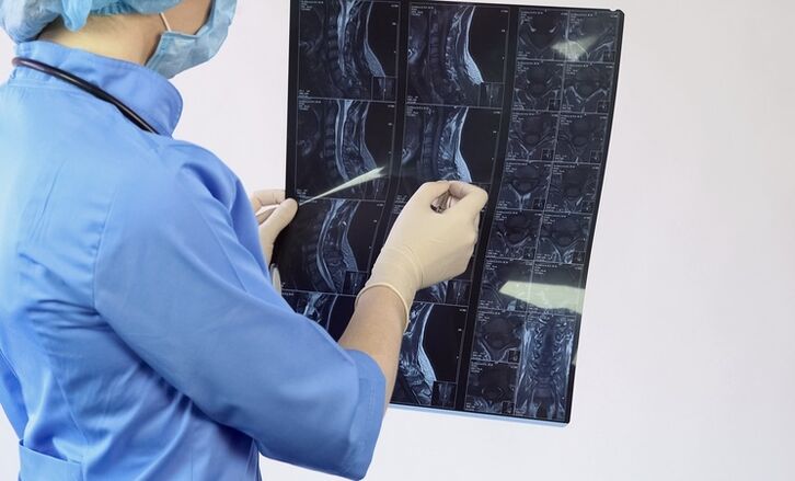 Rozpoznanie „osteochondrozy szyjnej stawia się na podstawie badania MRI
